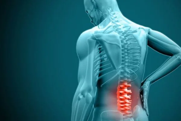 Slipped-Herniated Disc-Symptoms