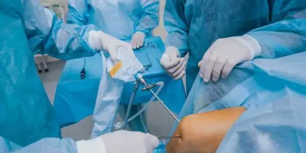 Knee Replacement Surgery in Delhi