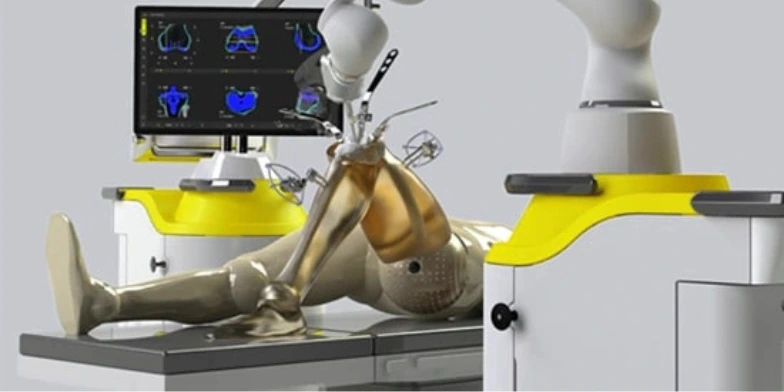 Robotic Knee Replacement Surgery